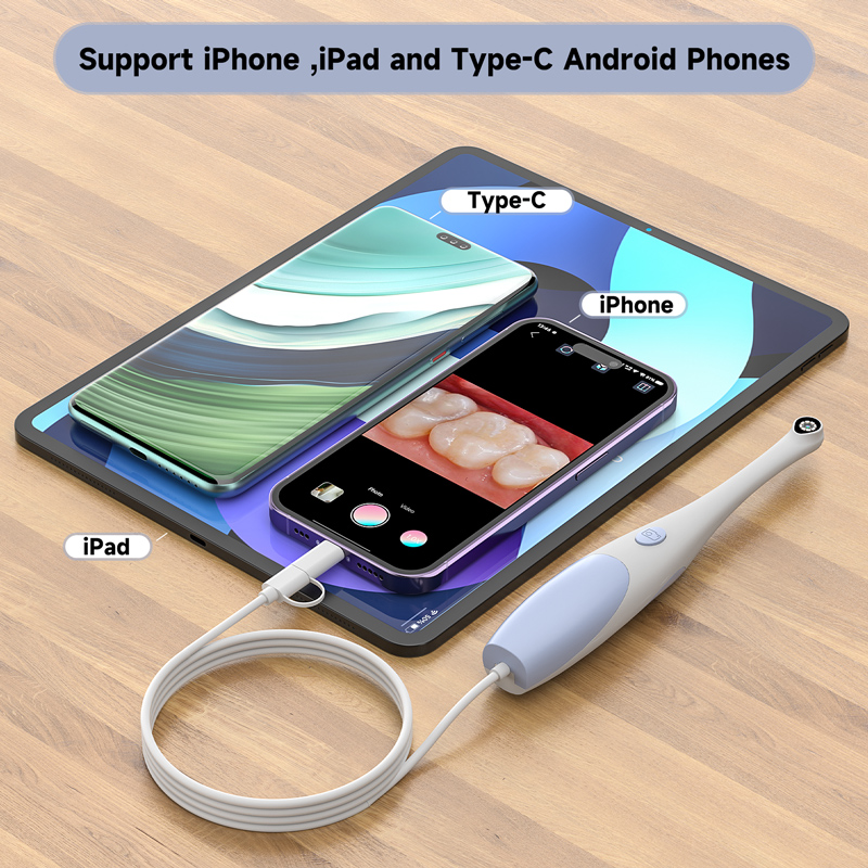 Type-C/iPhone対応 2 in 1 口腔内カメラ  - Endoscope Inspection Camera のレビューと価格